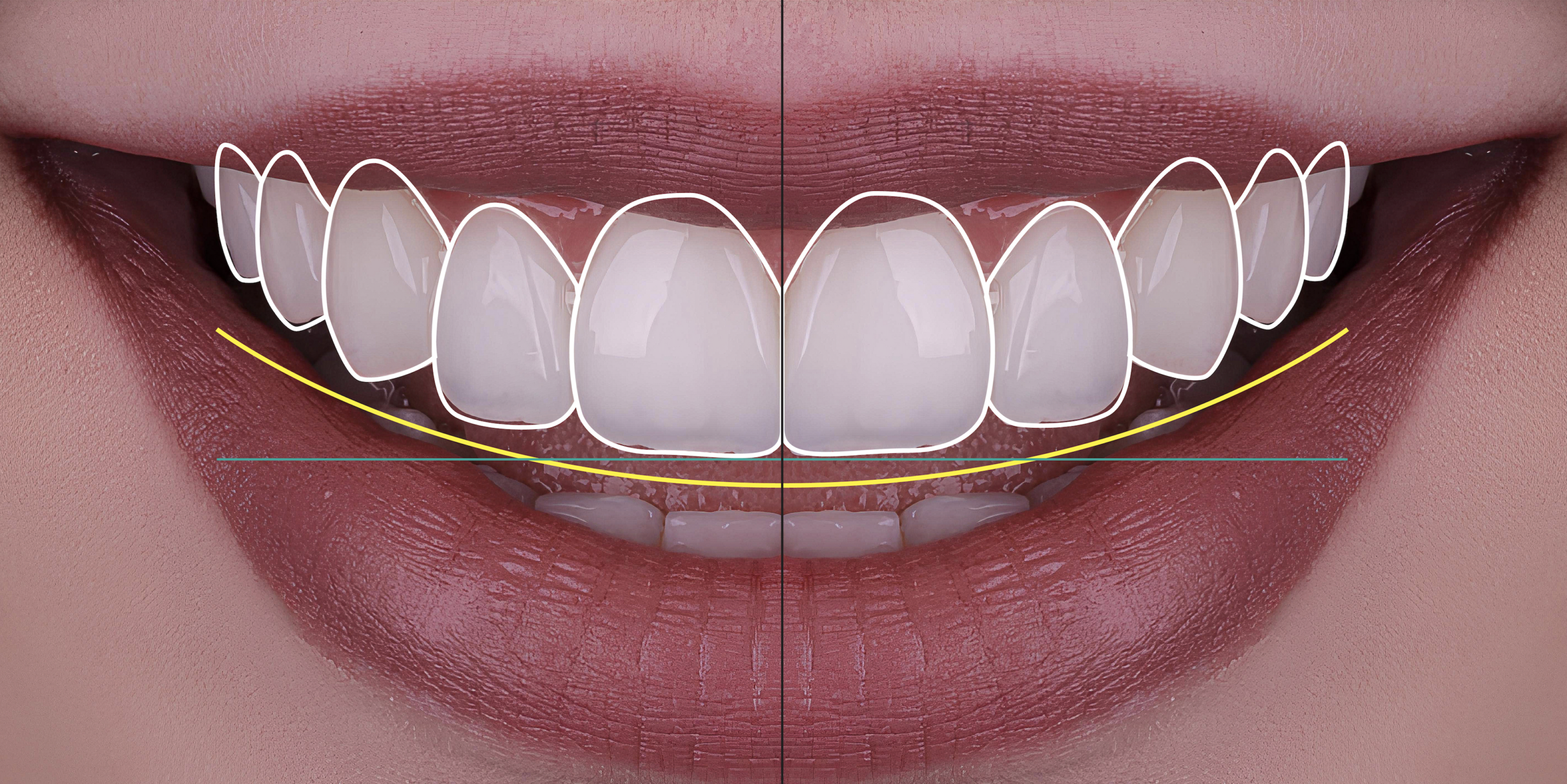 Featured image for “What a Smile Makeover Actually Involves (And Why It Starts With a Conversation)”